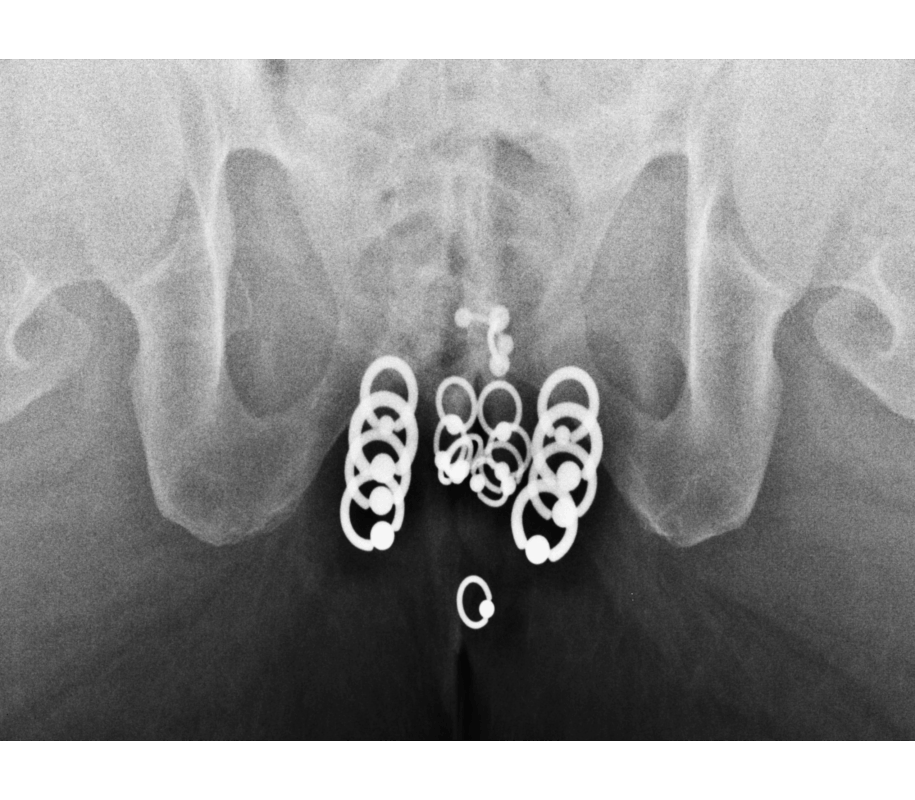 Ženské genitálne piercingy | Gemfire Ženské genitálne piercingy
